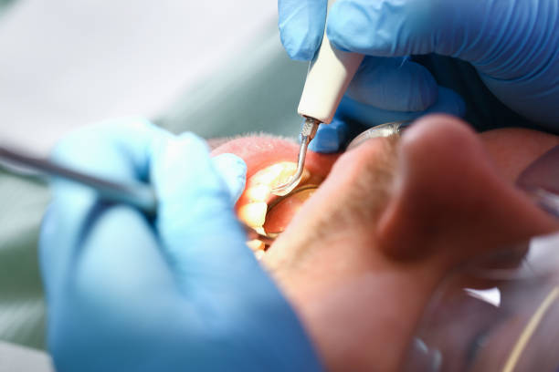 Best Pediatric Emergency Dentist in Twinsburg, OH