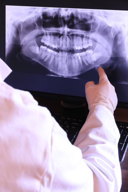 Best Emergency Treatment for Dental Infections or Abscesses in Twinsburg, OH